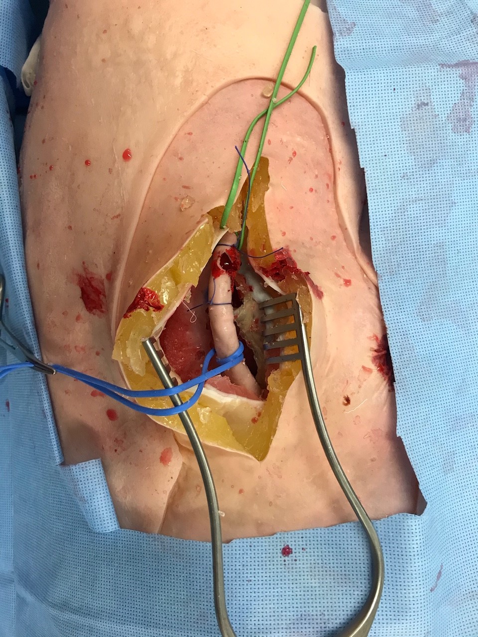Groin Insert